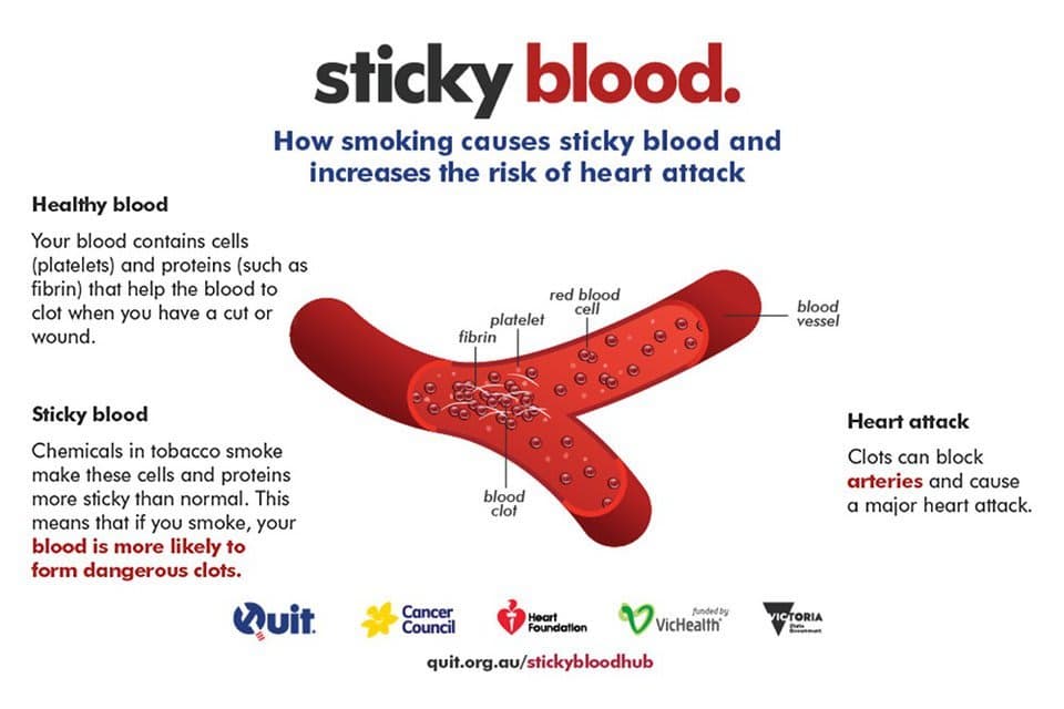 An infographic on how smoking causes sticky blood and increases the risk of heart attack